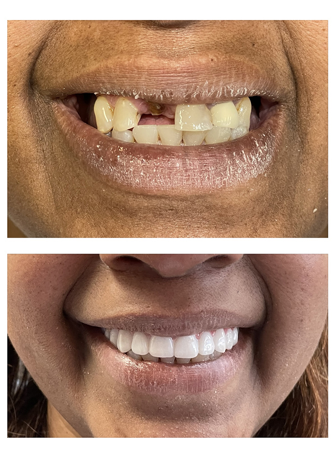 Before and after result 1
