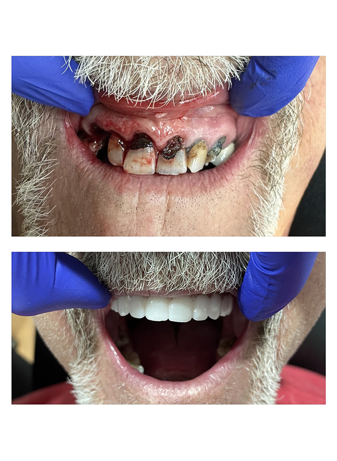 Before and after result 2