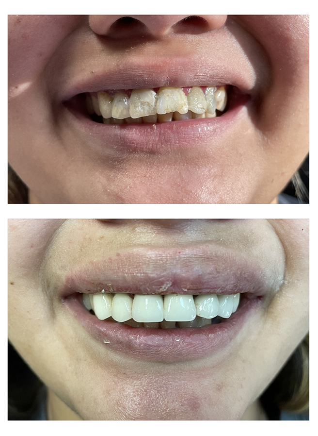 Before and after result 3