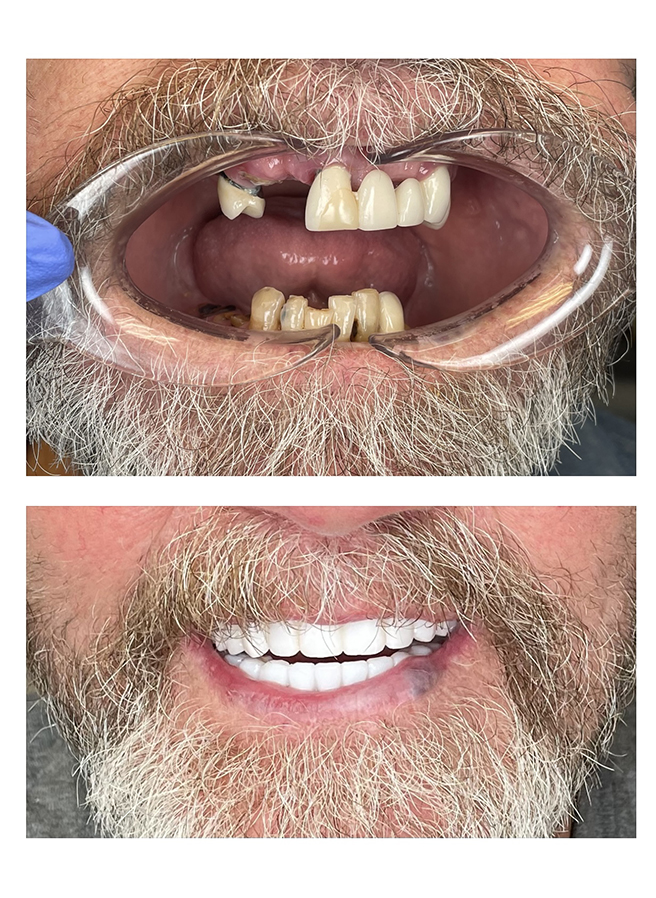 Before and after result 5
