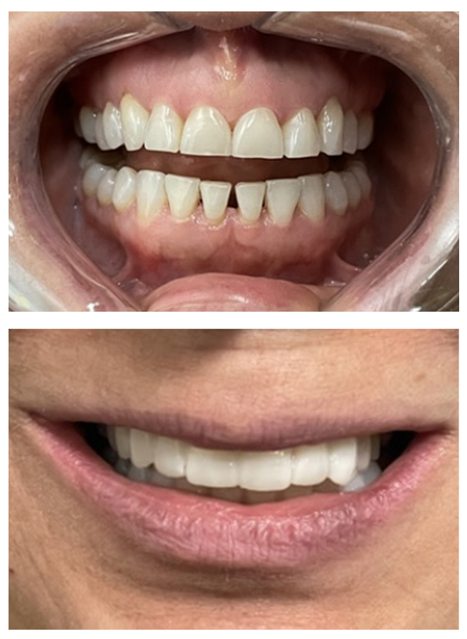 Before and after result 6