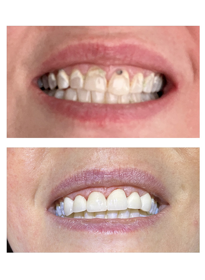 Before and after result 7