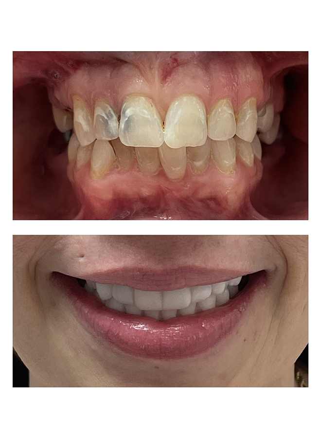 Before and after result 9