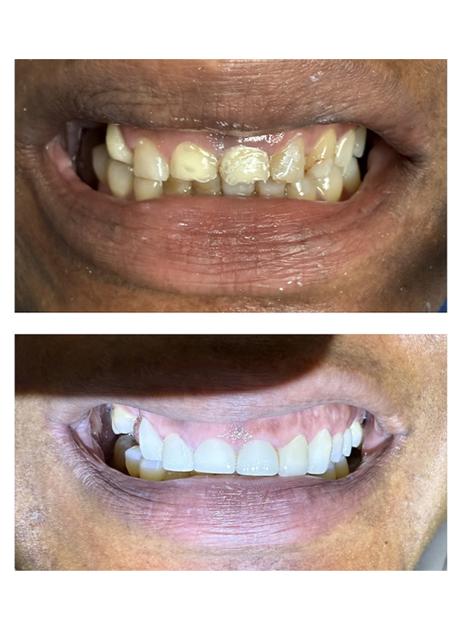 Before and after result 8